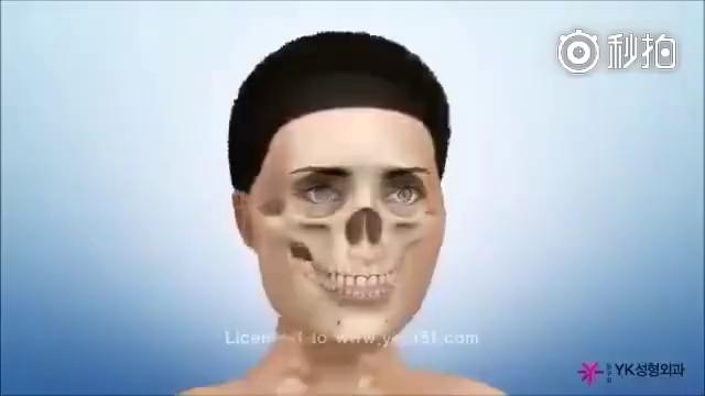 video-poster