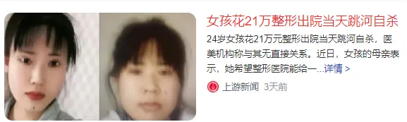 上海24岁女孩整容失败后自杀身亡，前后颜值照曝光，网友：太可惜了