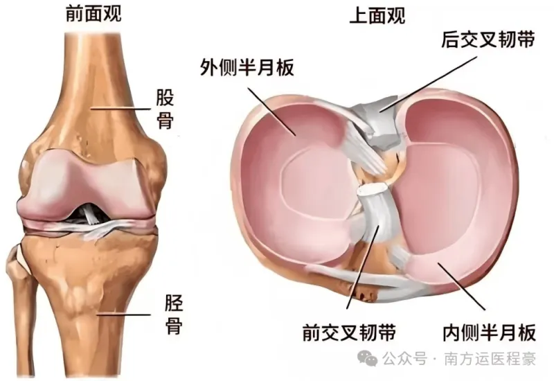 盘状半月板天生的“大号垫片”(图2)