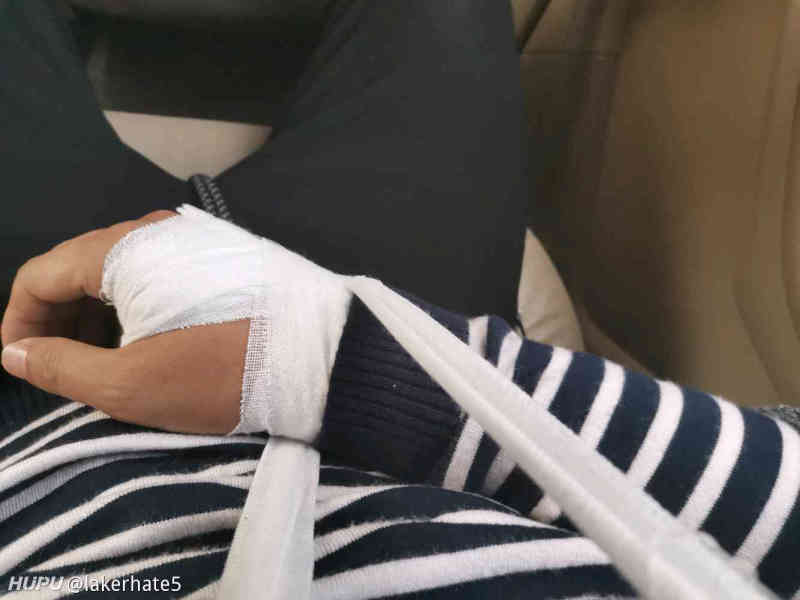 终于轮到我了 被下黑脚了 手肘骨折 虎扑 终于轮到我了 被下黑脚了 手肘骨折 虎扑
