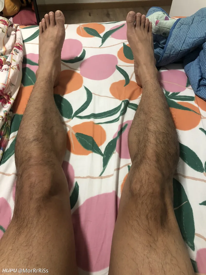 左腿3年两跟腱手术 退役篮球了 湿乎乎的话题 虎扑社区 左腿3年两跟腱手术 退役篮球了 湿乎乎的话题 虎扑社区
