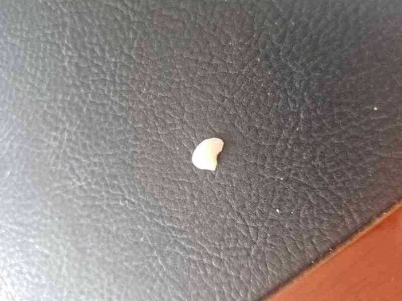 求助家人吗,虫牙被自己扣掉了该怎么弄