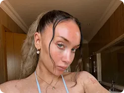 斯科尔斯女儿遭遇跑步机意外事故，脚趾严重受伤